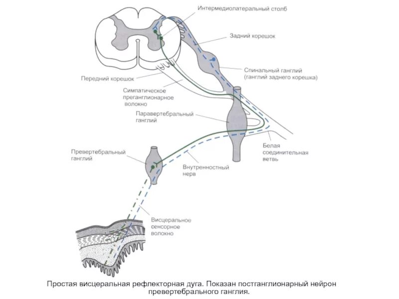Втсцеросоматические рефлексы. Блок схема спинального висцерального рефлекса. Блок схема спинального висцерального рефлекса. Висцеро-висцеральные рефлекторная дуга. Схема моторно-висцеральных рефлексов.