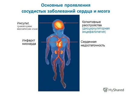 Сосудистое проявление
