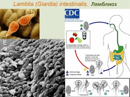 Локализация лямблий в организме человека
