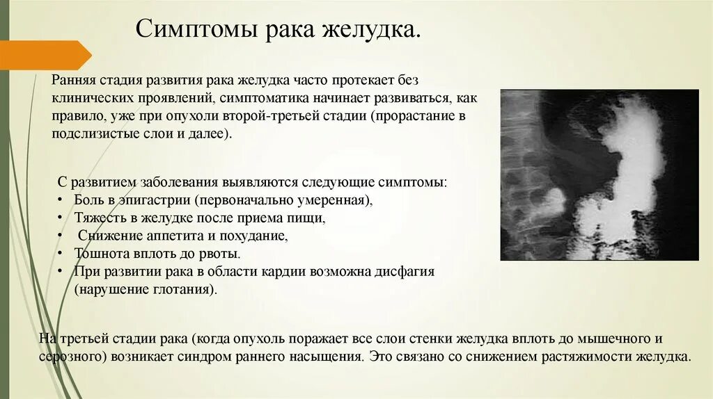 Признаки ранней онкологии у женщин. Симптомы при опухоли желудка. Онкология желудка симптомы. Опухоль желудка симптомы на ранней стадии. Онкология желудка первые симптомы.