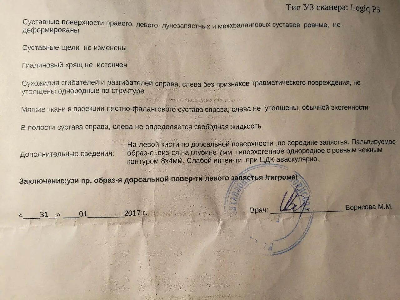 Операция по удалению гигромы - "Ходила я себе спокойненько на тренировки, стояла