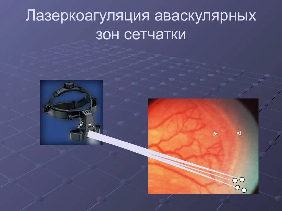 Ограничения после коагуляции