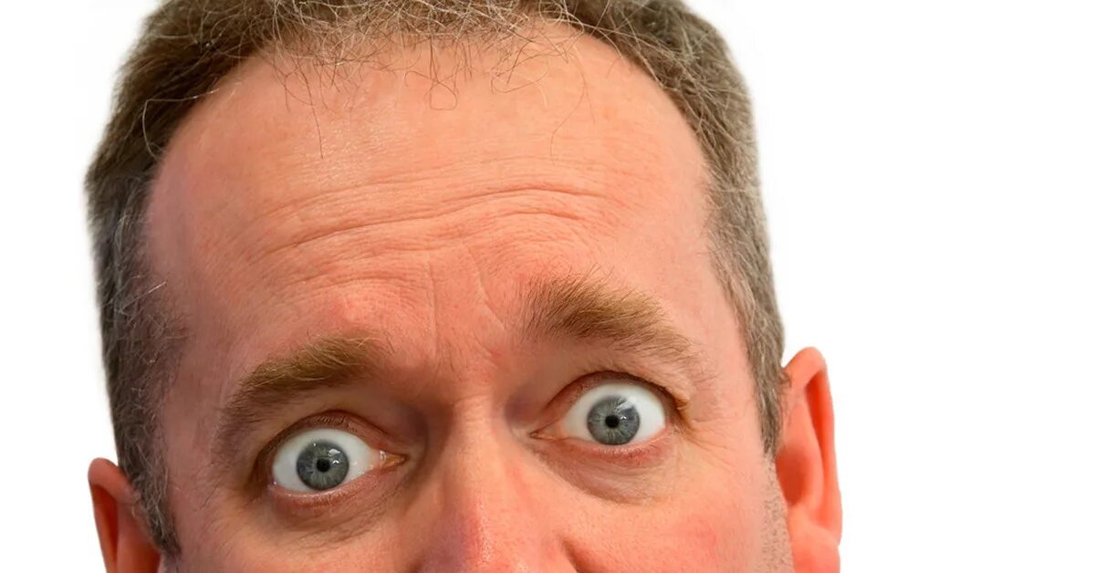 испуганная девушка. страшно удивлен. удивленные глаза. сильное удивление. эмоции человека удивление.