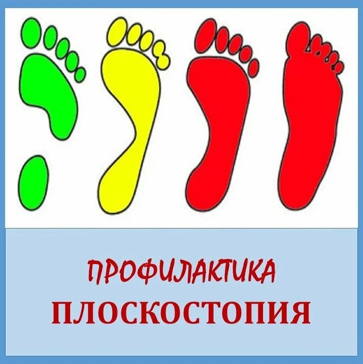Плоскостопие может быть предотвращено. Профилактика плоскостопия. профилактикаплоскостопие. профилактика плоскостопия у детей. плоскостопие у детей дошкольного возраста.