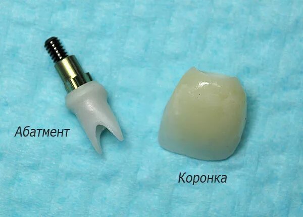Выпадает коронка импланта. Абатмент и коронка импланта. имплантат абатмент коронка. имплант абатмент коронка цирконий.