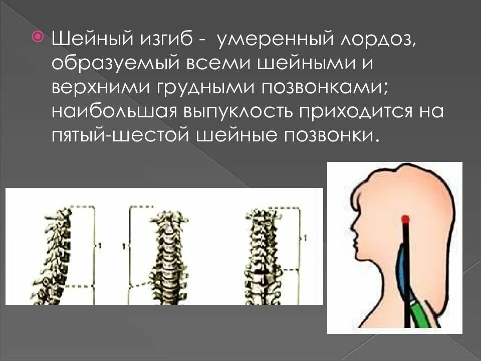 Шейный отдел сглажен. Шейный отдел сглажен