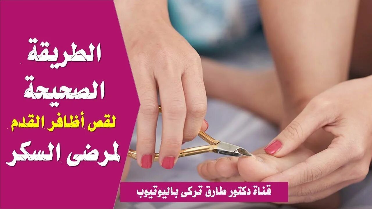 Как подстричь жесткие ногти на ноге
