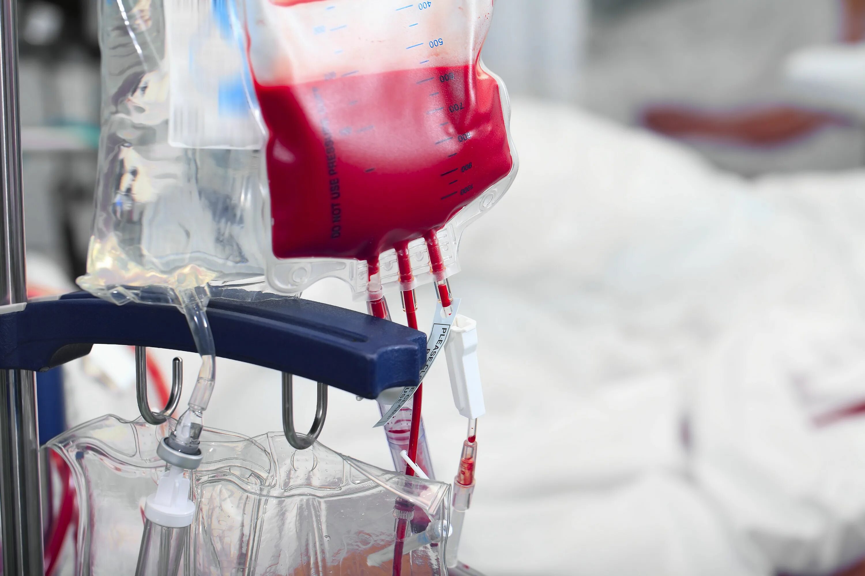 Гемотрансфузия. Переливание донорской крови. Переливание компонентов крови. Игра сосуды переливания