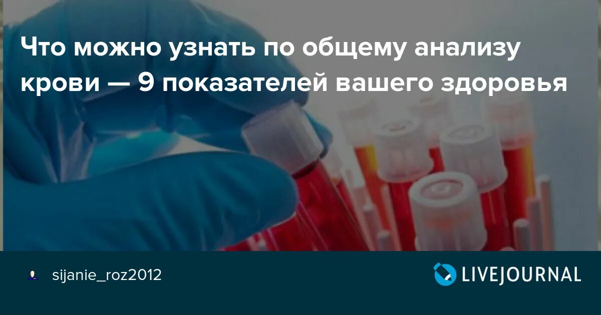 Кровь нужно сдавать натощак или нет. Кровь из пальца берут натощак. Как сдавать кровь из пальца натощак или нет. Кровь из пальца натощак или нет детям. Кровь из пальца и из вены разница.