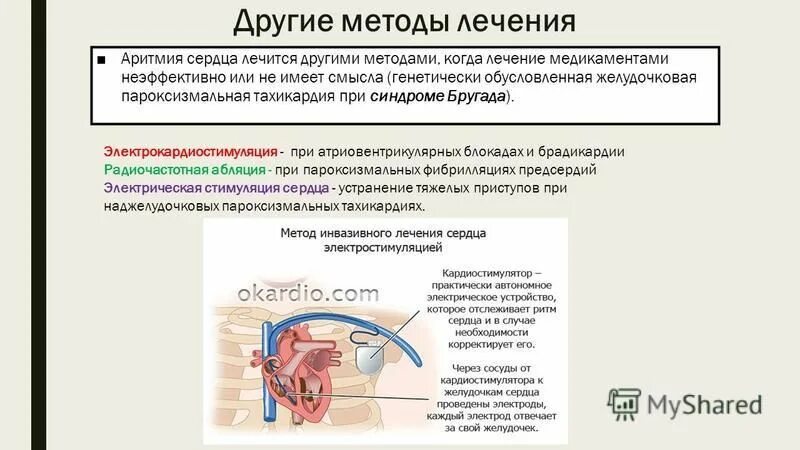 Берут ли с аритмией сердца в армию