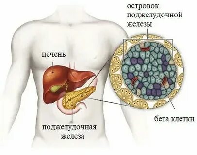 Конкременты в поджелудочной железе