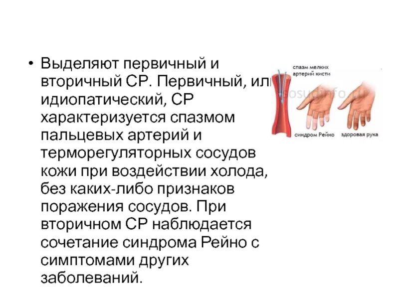 Почему судороги на пальцах рук. Спазмы периферических сосудов. Синдром Рейно первичный вторичный. Симптоматическое поражение периферических артерий.