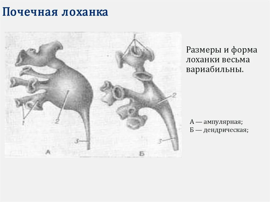 Ампулярная лоханка. Типы строения лоханки почки. Типы строения почечных лоханок. Ампулярный Тип лоханки.