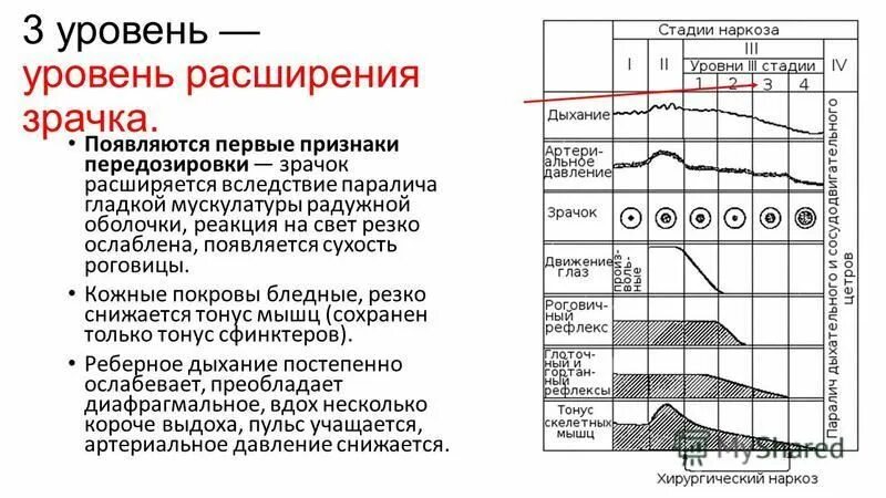 Контроль анестезии