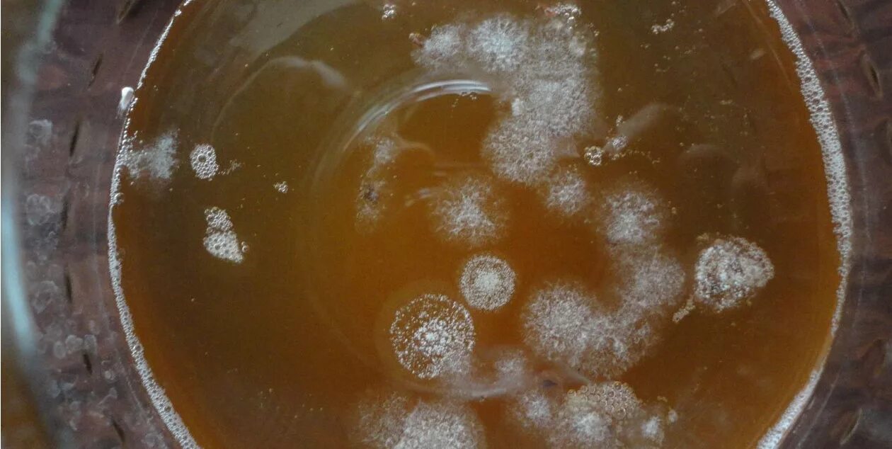 Зооглея чайный гриб. Чайный гриб уксуснокислые бактерии. Чайный гриб под микроскопом. Чайный гриб заплесневел. В банке появилась плесень