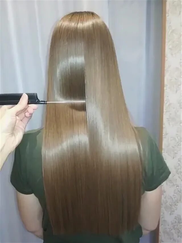 Ботокс спины. Ботокс спины