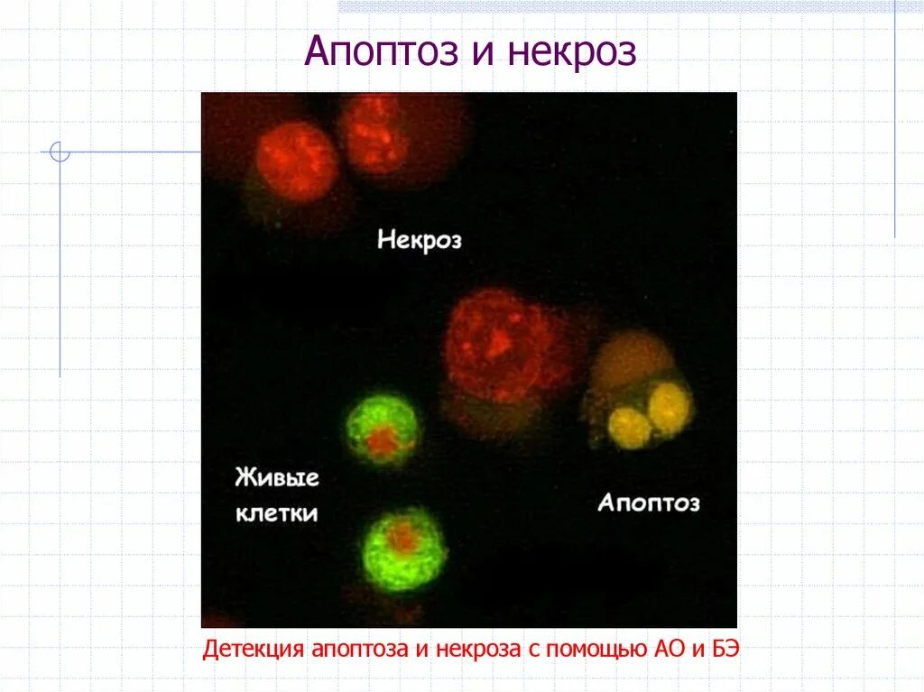 Апоптоз и некроз схема. Апоптоз отмирание клеток. Некроз и апоптоз клетки. Апоптоз клетки. Апоптоз клеток это