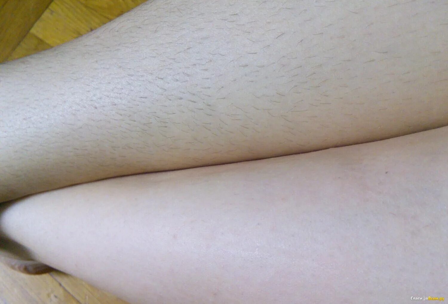 Светлые волосы на ногах. Голени до и после шугаринга.