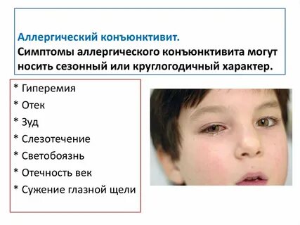 Частый конъюнктивит у взрослого