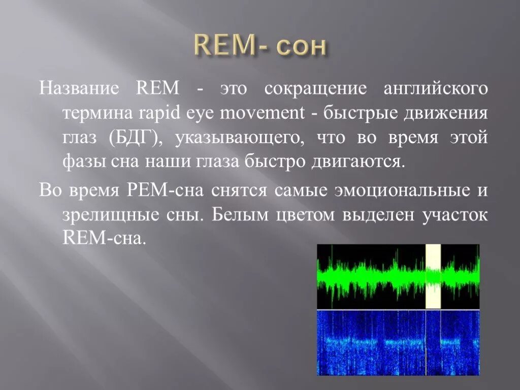 Сон называть. Rem фаза сна. Фазы сна Rem сон. Non Rem фазы сна что это. Rem non Rem фазы сна.