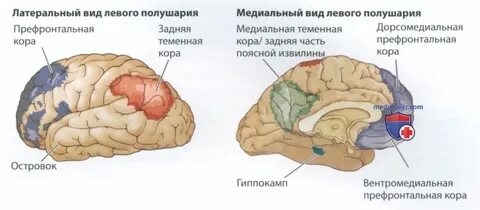 Инсульт лобной доли