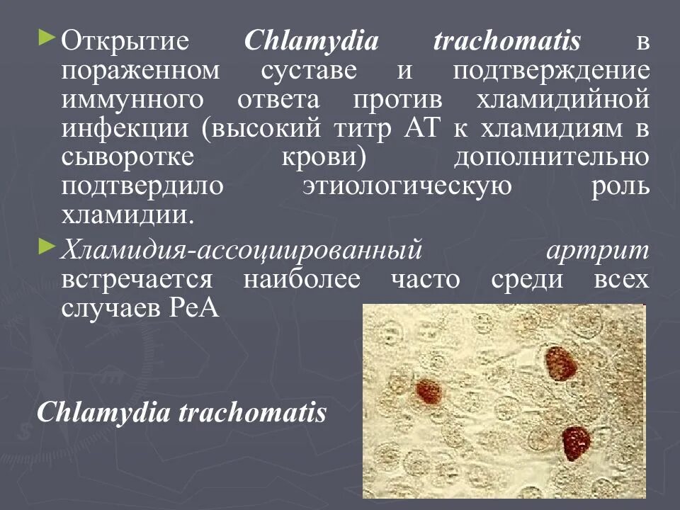 Chlamydia trachomatis. Хламидия трахоматис возбудитель. Хламидия трахоматис симптомы.