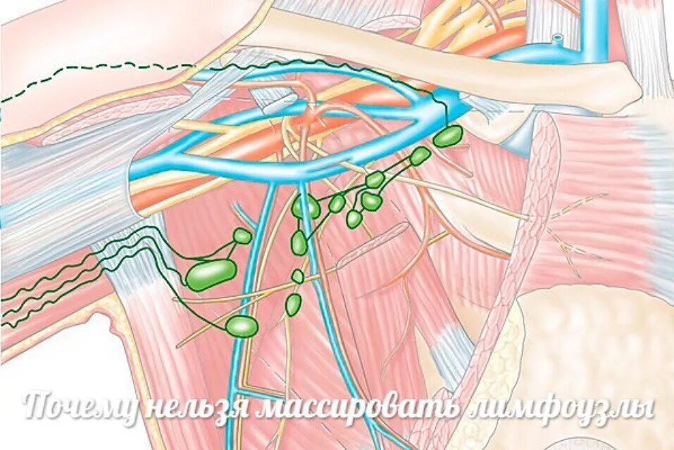 Интрамаммарный лимфоузел. Лимфатическая система подмышечная. Аксиллярные подмышечные лимфоузлы. Аксиллярные лимфоузлы молочной железы. Лимфоузел после массажа