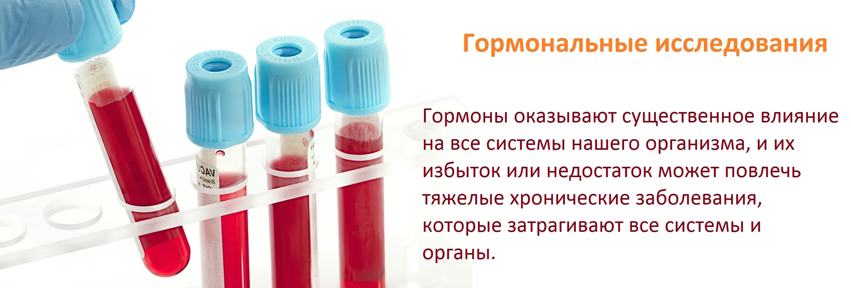 Неприятные анализы. Пробирки для забора крови из вены для биохимического исследования. Гормональные исследования. Гормональные исследования крови.