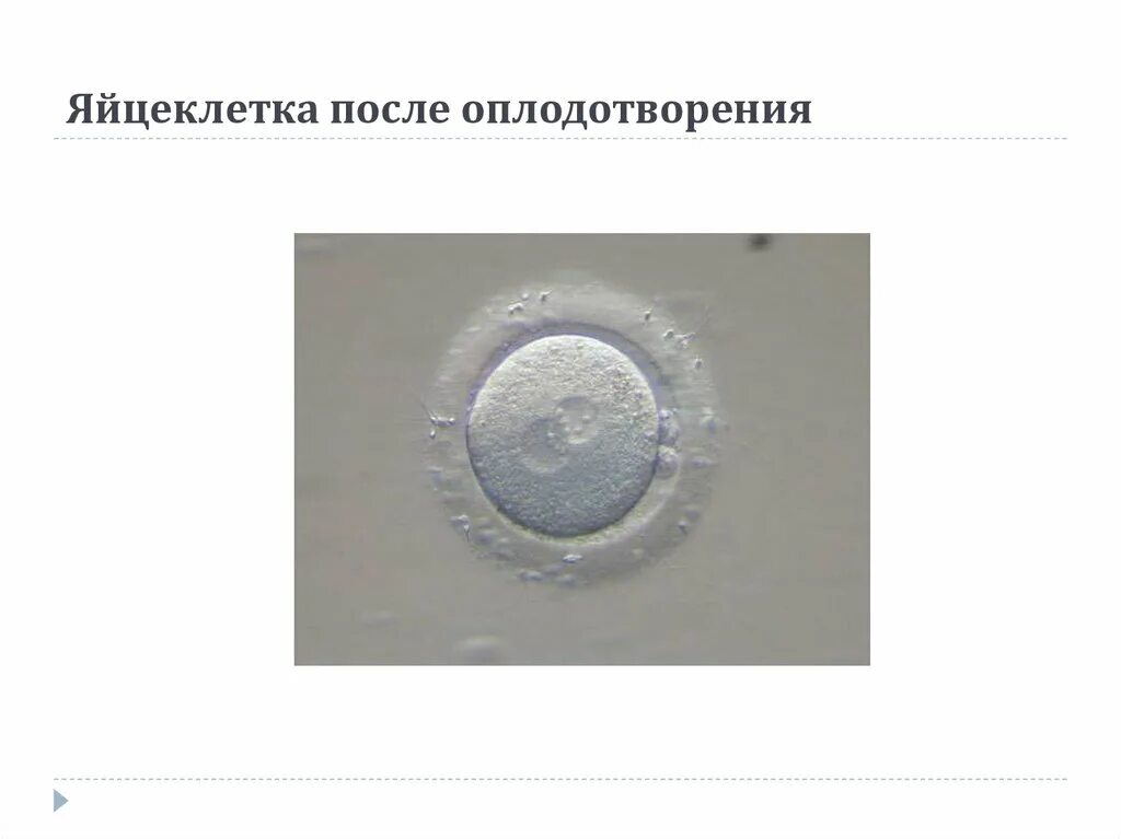 После оплодотворения яйцеклетки и первых делений. Яйцеклетка после оплодотворения. Деление яйцеклетки после оплодотворения. Диаметр яйцеклетки человека. Развитие яйцеклетки по дням.