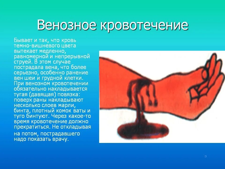 Что значит сильная кровь. Артериальное и венозное кровотечение. Венозное кровотечение характеризуется. Венозная кровотичение.