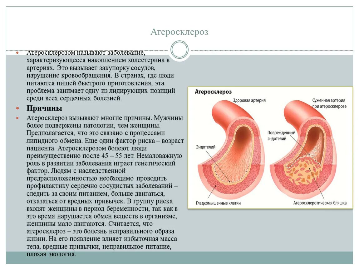 Заболевание сосудов называется. Атеросклеротическая болезнь сердца 125.1. Атеросклеротическая болезнь сердца 125.1 причина. Атеросклеротическая болезнь сердца 125.1 расшифровка. Атеросклеротическая болезнь се.