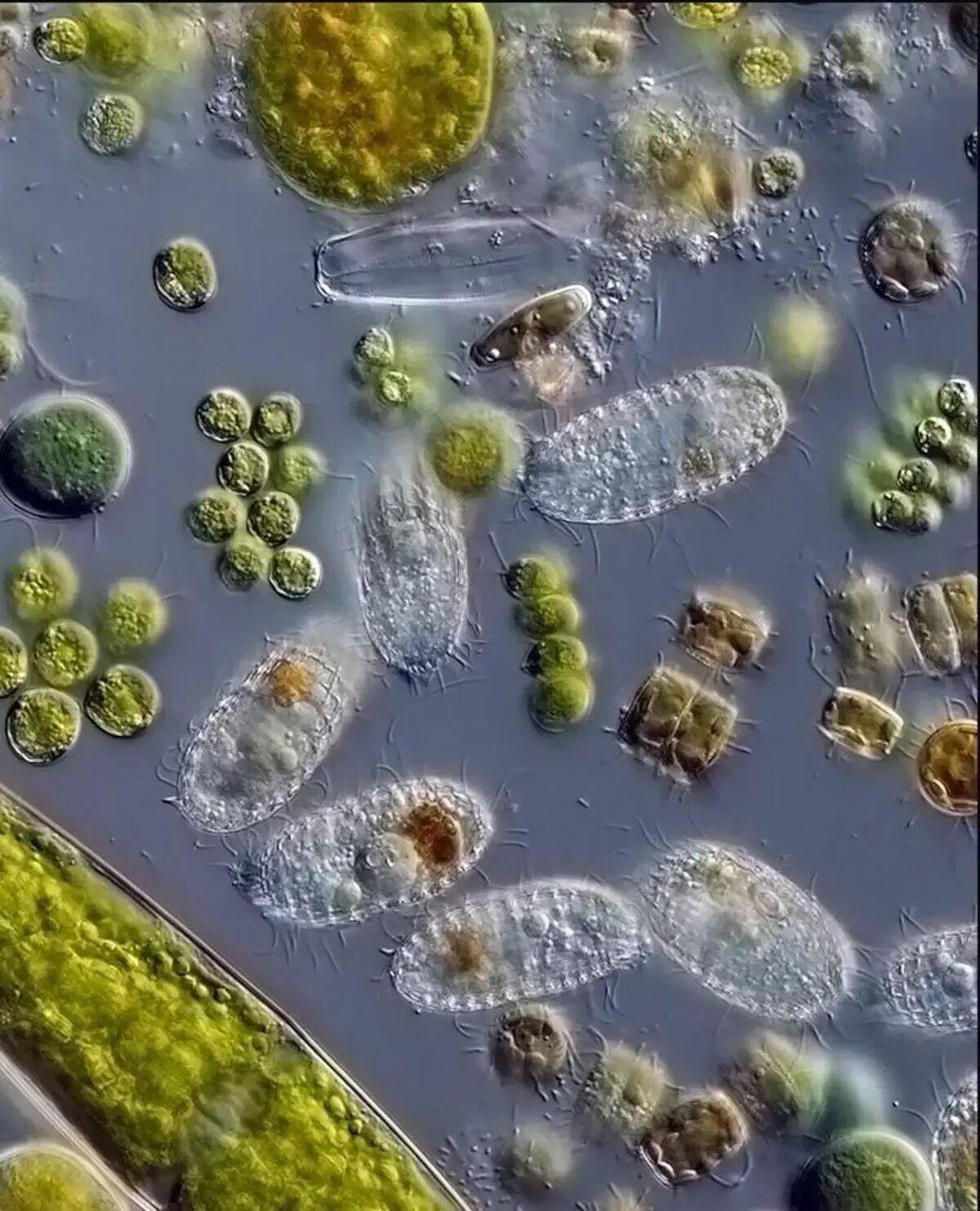 Бактерии в воде под микроскопом. Микроорганизмы в воде под микроскопом. Микробы в капле воды под микроскопом. Бактерии под микроскопом.