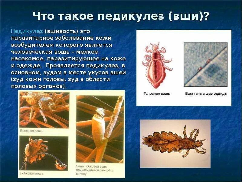 При какой температуре погибает вша и гнид. При какой температуре погибает вша и гнид