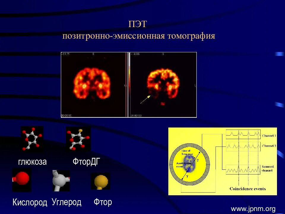 Позитронно-эмиссионная томография мозга (пэт). Окраска простых веществ неметаллов. Химические свойства фосфора с хлором. Сказка о химико. Хлорид водорода формула.