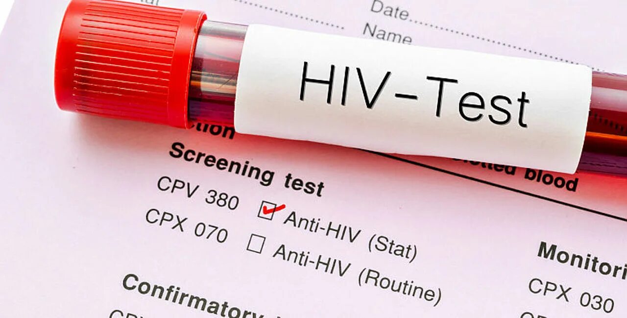 HIV Test. HIV AIDS. Хив тест. Тест на HIV.