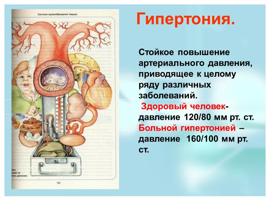 Гипертензия что. Гипертония. Механизм повышения артериального давления в организме человека. Стойкое повышение артериального давления у человека. Механизм высокого кровяного давления.