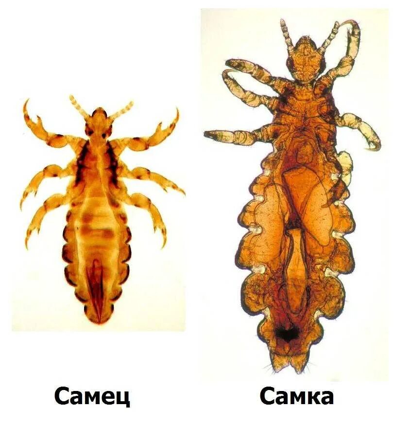 Где обитают вши
