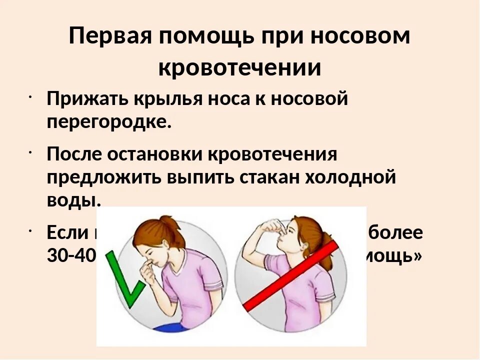 Что делать при кровотечении из носа. Оказание первой мед помощи при носовом кровотечении. пмп при кровотечении из носа. оказание первой помощи пострадавшему при кровотечении из носа. оказание пмп при носовом кровотечении.