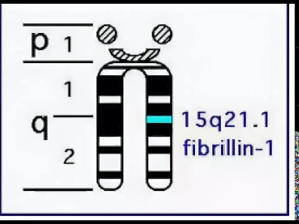 Ген fbn1. Ген фибриллин 1.