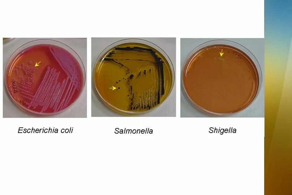 Посев на шигеллы и сальмонеллы. Среда Плоскирева микробиология. Сальмонеллы на среде Эндо. Эшерихии на среде Плоскирева. Посев на сальмонеллез