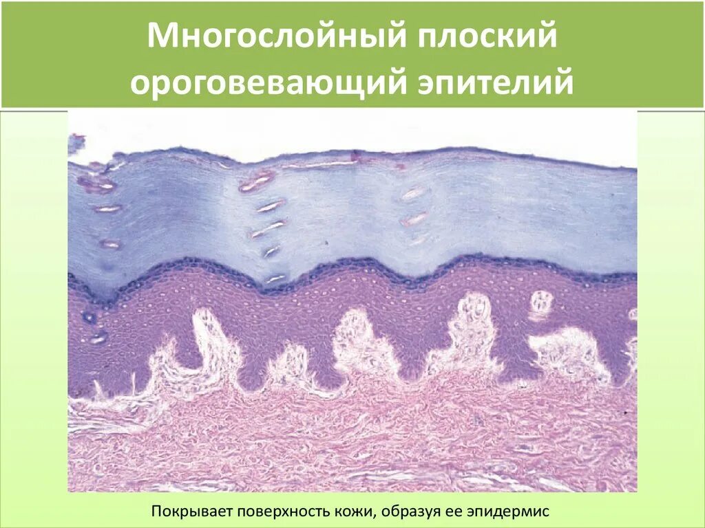 Многослойный плоский неороговевающий эпителий препарат. Плоский неороговевающий эпителий функции. Многослойный плоский эпителий строение. Многослойный плоский ороговевающий эпителий строение. Многослойный плоский ороговевший эпителий.