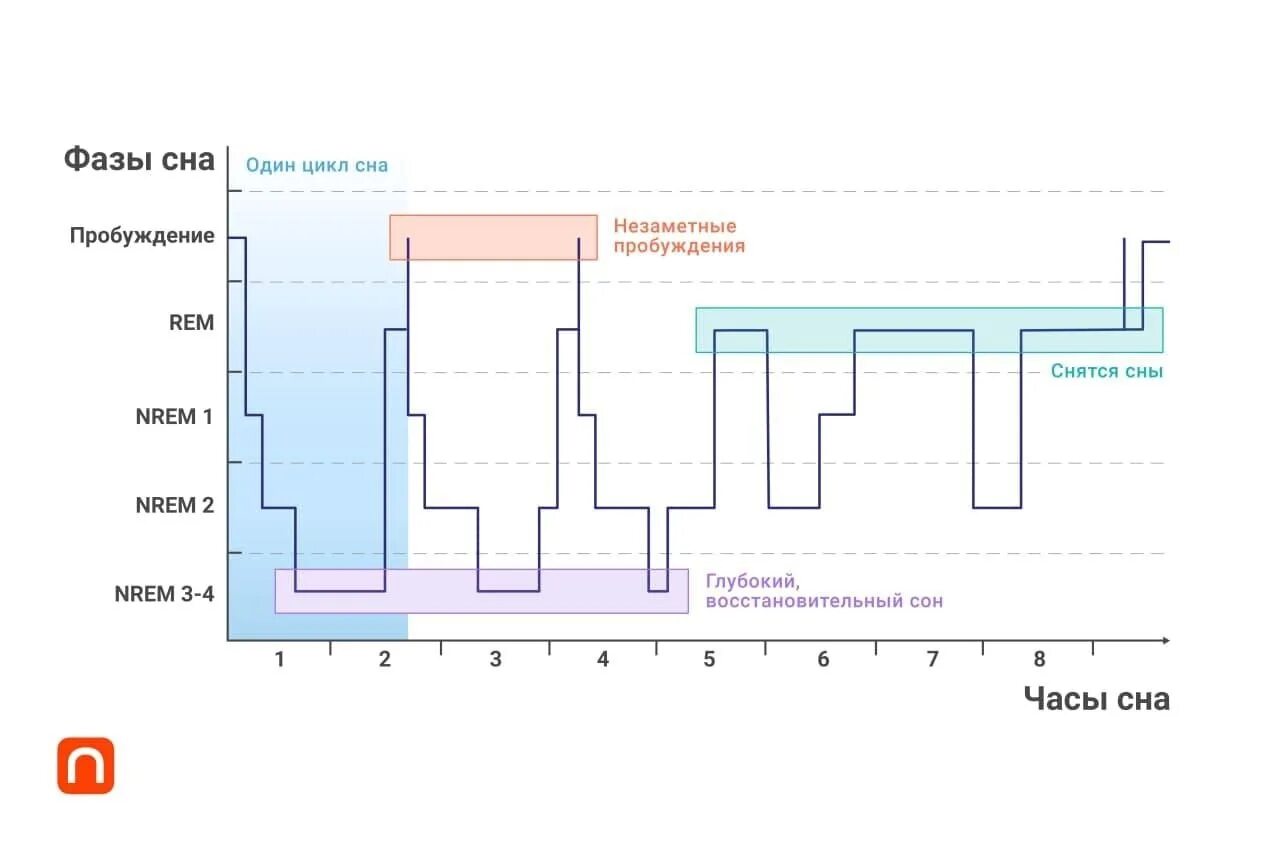 Фазы сна человека диаграмма. Нормальный график фаз сна. Фазы сна на графике. Фазы сна человека в графике. Цикл пробуждение