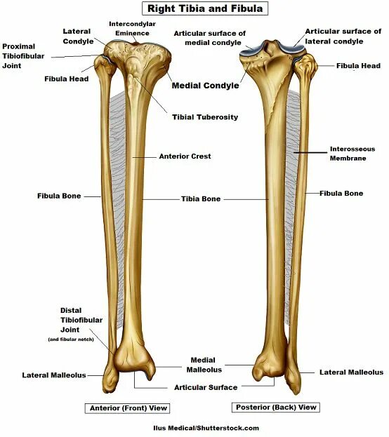 Curved tibia fibula