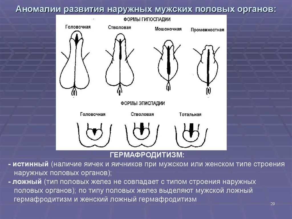 Формы женских половых органов. Аномалии развития наружных половых органов. Формы мужских половых органов. Формы женского полового органа.