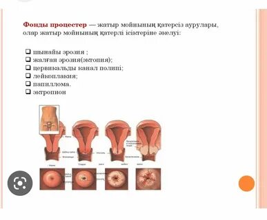 Транни сорады өз мүшесі порно видео