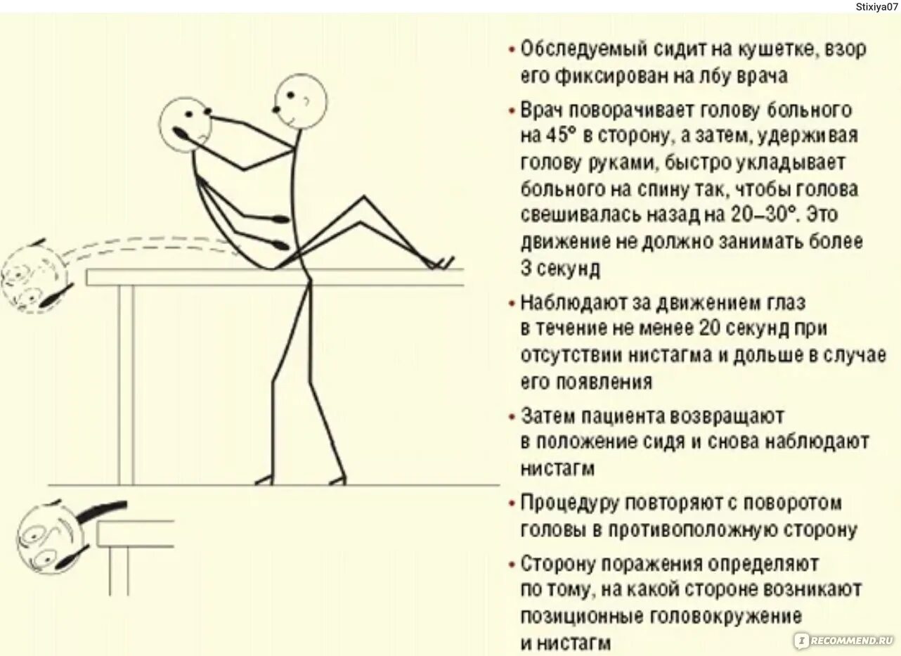 Проба холпайка. Позиционные пробы при головокружении. Позиционная проба Дикса-Холлпайка. ДППГ проба Дикса-Холпайка. Позиционные тесты пробы Дикса-Холлпайка.