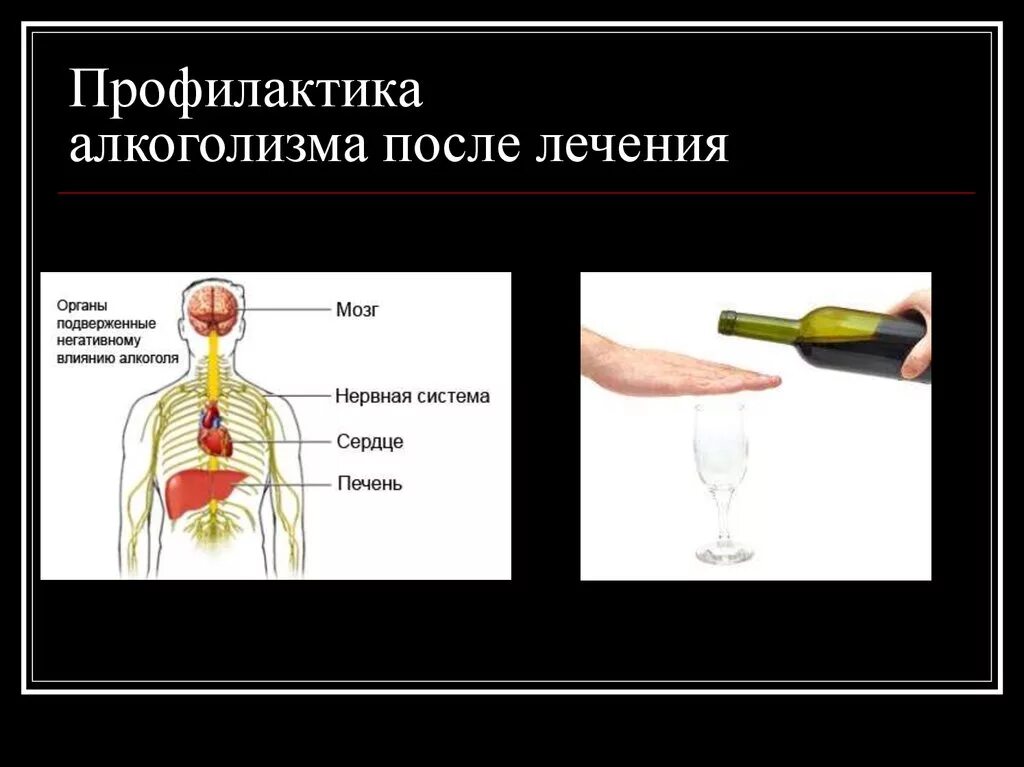 Профилактика алкоголизма. Методы профилактики алкоголизма. Профилактика алкоголизма презентация. Включить алкогольный