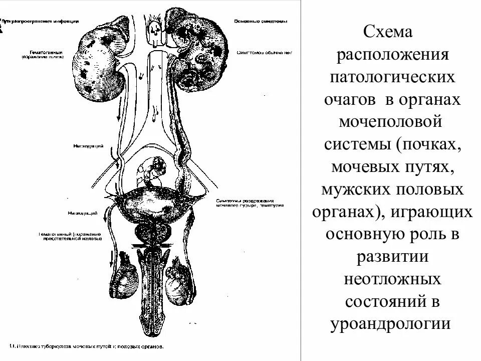 Орган мужской половой системы человека. Мужская мочевыделительная система схема. Анатомия человека мужская Мочеполовая система. Схема мочевыделительной системы у мужчин. Схема мочеполовой системы у мужчин.