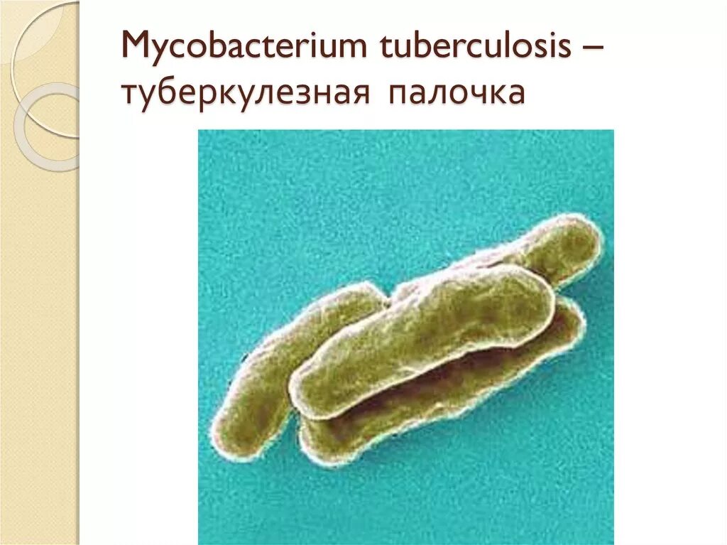 Микобактерия туберкулеза палочка Коха. Микобактерия палочки Коха. Палочка Коха туберкулез. Палочки – микобактерия туберкулеза. Туберкулез tuberculosis