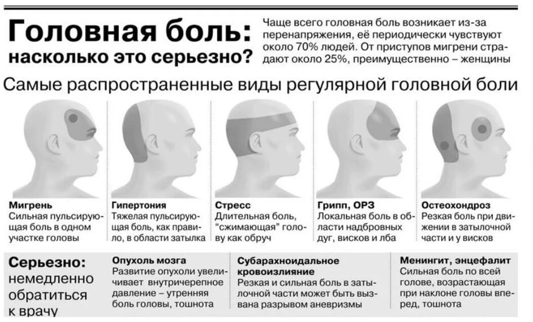 Какая боль больнее. Сильная головная боль сзади головы. Классификация головной боли по локализации. Причины головной боли. Головная боль в висках.